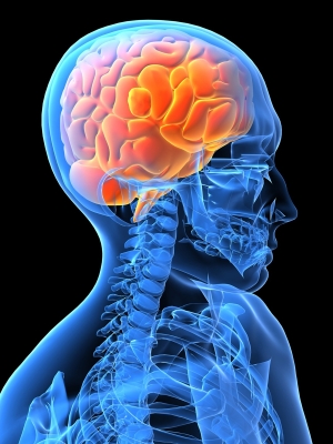 When headaches happen, my brain feels orange.  Doesn't yours?